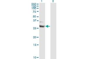 Western Blot analysis of CIDEA expression in transfected 293T cell line by CIDEA monoclonal antibody (M01), clone 4B9. (CIDEA antibody  (AA 1-253))