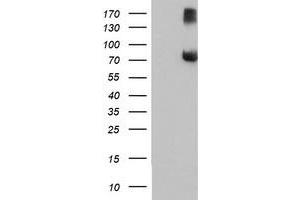 Western Blotting (WB) image for anti-F-Box Protein 21 (FBXO21) antibody (ABIN1498238) (FBXO21 antibody)