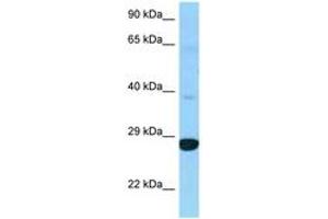 Image no. 1 for anti-Dehydrogenase/reductase (SDR Family) Member 4 Like 2 (DHRS4L2) (C-Term) antibody (ABIN6748237)