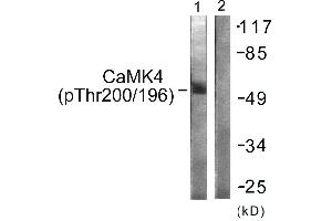 Immunohistochemistry analysis of paraffin-embedded human brain tissue using CaMK4 (Phospho-Thr196/200) antibody.
