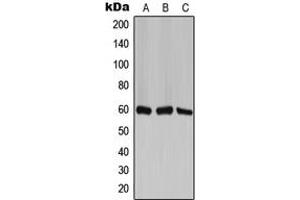 Western blot analysis of TCP1 zeta expression in H1299 (A), mouse brain (B), PC12 (C) whole cell lysates. (CCT6A antibody  (Center))