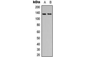 Western blot analysis of ACK1 (pY284) expression in SHSY5Y (A), HeLa (B) whole cell lysates.