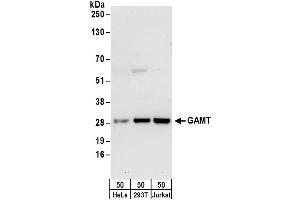 Western Blotting (WB) image for anti-Guanidinoacetate N-Methyltransferase (GAMT) (AA 1-50) antibody (ABIN7449739)