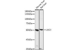 Western blot analysis of extracts of various cell lines, using L antibody (ABIN1680647, ABIN1680648, ABIN5664204 and ABIN6219974) at 1:500 dilution. (LAG3 antibody  (AA 29-170))