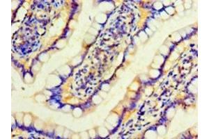 Immunohistochemistry of paraffin-embedded human small intestine tissue using ABIN7156569 at dilution of 1:100 (IFNA4 antibody  (AA 24-189))