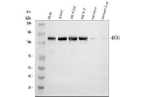 Western blot analysis of ECE1 using anti-ECE1 antibody (ABIN5518828). (ECE1 antibody  (AA 18-233))
