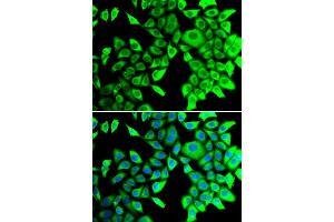 Immunofluorescence analysis of A549 cell using THADA antibody. (THADA antibody)