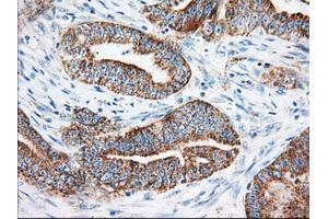 Immunohistochemical staining of paraffin-embedded Human liver tissue using anti-KHK mouse monoclonal antibody.