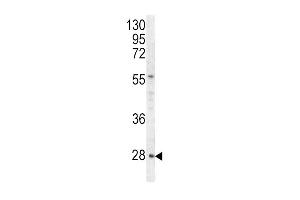 Western blot analysis of HPRT1 antibody (C-term) (ABIN390692 and ABIN2840982) in Hela cell line lysates (35 μg/lane). (HPRT1 antibody  (C-Term))