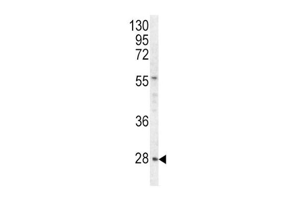 HPRT1 antibody  (C-Term)