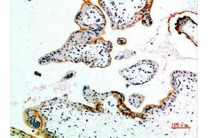 Immunohistochemical analysis of paraffin-embedded human-placenta, antibody was diluted at 1:200 (EDNRB antibody  (AA 31-80))