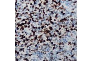 Immunohistochemical analysis of CCNB1IP1 staining in human lymph node formalin fixed paraffin embedded tissue section.