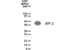 Western Blotting (WB) image for anti-Activating Transcription Factor 2 (ATF2) (AA 13-27) antibody (ABIN208330) (ATF2 antibody  (AA 13-27))