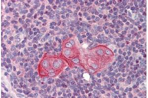 Human Thymus (formalin-fixed, paraffin-embedded) stained with TGFB1I1 antibody ABIN462214 followed by biotinylated goat anti-rabbit IgG secondary antibody ABIN481713, alkaline phosphatase-streptavidin and chromogen. (TGFB1I1 antibody  (N-Term))