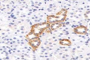 Immunohistochemistry analysis of paraffin-embedded rat kidney using,IVD (ABIN7074382) at dilution of 1: 2800 (IVD antibody)
