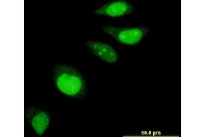 Immunofluorescence of monoclonal antibody to EDF1 on HeLa cell.
