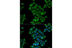 Immunofluorescence analysis of HeLa cells using CTNS antibody. (CTNS antibody)
