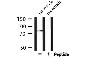 LRSAM1 antibody  (Internal Region)