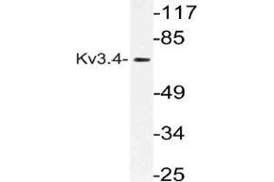 Western blot (WB) analysis of Kv3. (Kv3.4 antibody)