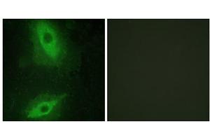 Immunofluorescence analysis of HeLa cells, using TNFSF15 antibody.