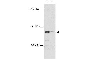 Western blot using  anti-MTBP antibody shows detection of a band ~110 kDa corresponding to human MTBP (arrowhead). (MTBP antibody  (AA 667-812))