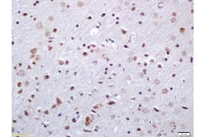 Formalin-fixed and paraffin embedded rat brain labeled with Anti-Phosphoserine/threonine Polyclonal Antibody, Unconjugated (ABIN1385068) at 1:200 followed by conjugation to the secondary antibody and DAB staining (Phosphoserine/Threonine (phosphorylated) antibody)
