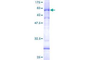 AP4M1 Protein (AA 1-453) (GST tag)