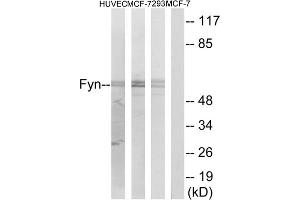 Western blot analysis of extracts from HUVEC cells, MCF-7 cells and 293 cells, using Fyn (epitope around residue 530) antibody. (FYN antibody  (Tyr530))