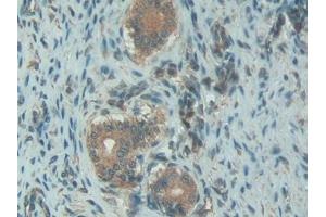 Detection of C1INH in Rat Uterus Tissue using Polyclonal Antibody to Complement 1 Inhibitor (C1INH) (SERPING1 antibody  (AA 148-270))
