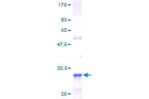 Image no. 1 for Protein Kinase C, eta (PRKCH) (AA 1-41) protein (GST tag) (ABIN1316267) (PKC eta Protein (AA 1-41) (GST tag))