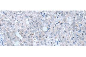 Claudin 12 antibody