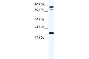 Western Blot showing ZFP287 antibody used at a concentration of 1-2 ug/ml to detect its target protein. (ZNF287 antibody  (N-Term))