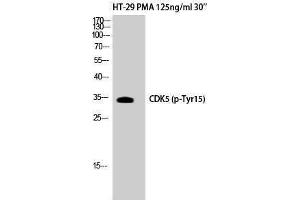 Western Blotting (WB) image for anti-Cyclin-Dependent Kinase 5 (CDK5) (pTyr15) antibody (ABIN3179551) (CDK5 antibody  (pTyr15))