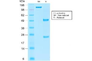 SDS-PAGE Analysis Purified EpCAM Mouse Recombinant Monoclonal Antibody (rEGP40/1110). (Recombinant EpCAM antibody  (Cytoplasmic Domain))