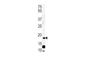 RCL Antibody (N-term) (ABIN652111 and ABIN2840553) western blot analysis in CEM cell line lysates (35 μg/lane). (RCL antibody  (N-Term))