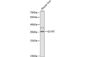 Western blot analysis of extracts of mouse liver, using GLYAT antibody (ABIN6131946, ABIN6141164, ABIN6141166 and ABIN6218343) at 1:3000 dilution.