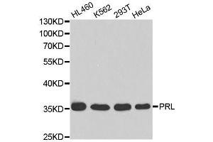 Western blot analysis of extracts of various cell lines, using PRL antibody. (Prolactin antibody  (AA 29-227))
