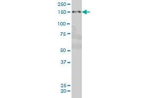 ZMYND8 monoclonal antibody (M01), clone 5B12 Western Blot analysis of ZMYND8 expression in Hela S3 NE .