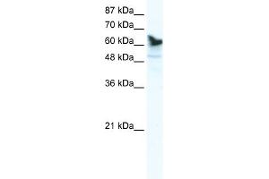 WB Suggested Anti-DDX41 Antibody Titration:  1.