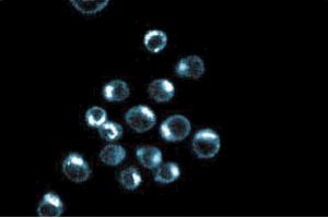 Immunoflouresence staining of HeLa cells. (p230 Trans Golgi (AA 2063-2179) antibody)