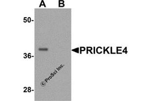 Western Blotting (WB) image for anti-Prickle Homolog 4 (PRICKLE4) (N-Term) antibody (ABIN1077371) (PRICKLE4 antibody  (N-Term))