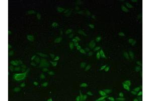 Detection of CYP1A2 in Hela cells using Polyclonal Antibody to Cytochrome P450 1A2 (CYP1A2) (CYP1A2 antibody  (AA 192-444))