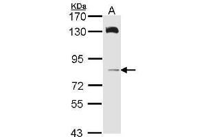 WB Image Sample (30 ug of whole cell lysate) A: A431 , 7. (HPS6 antibody  (Internal Region))