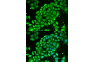 Immunofluorescence analysis of U2OS cells using TCL1A antibody (ABIN5970229). (TCL1A antibody)