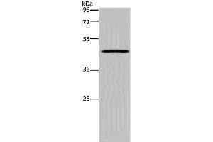 Western Blot analysis of Mouse lung tissue using MECP2 Polyclonal Antibody at dilution of 1:300 (MECP2 antibody)