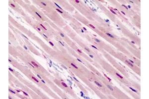 Human Heart: Formalin-Fixed, Paraffin-Embedded (FFPE) (GATA3 antibody  (N-Term))