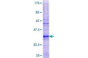 ATP5G3 Protein (AA 1-142) (GST tag)