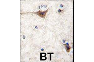 Formalin-fixed and paraffin-embedded human brain tissue reacted with CDH10 antibody (N-term), which was peroxidase-conjugated to the secondary antibody, followed by DAB staining. (CDH10 antibody  (N-Term))
