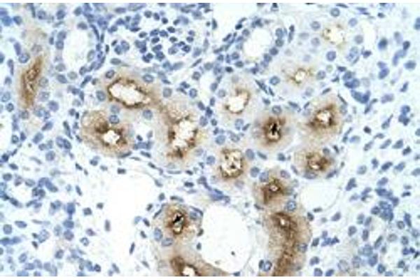 GGTLC1 antibody  (C-Term)
