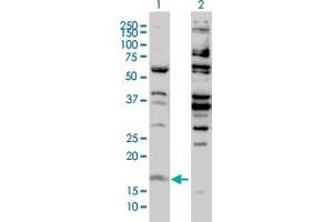 Western Blot analysis of H3F3B expression in transfected 293T cell line by H3F3B monoclonal antibody (M01), clone 2D7-H1. (H3F3B antibody  (AA 1-136))